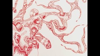 Grotesque Ink & Pen Drawing: Periodontitis (WORK IN PROGRESS)