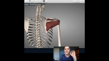 Rotator cuff tendinopathy- Great exercise to prevent it