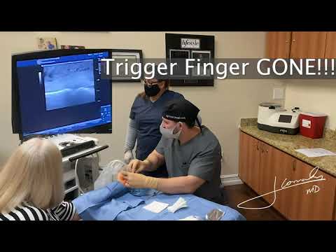 Live Trigger Finger Surgery!! Patient Awake, NO pain!!