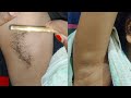 Straight Razor Shaving Underarms Hair