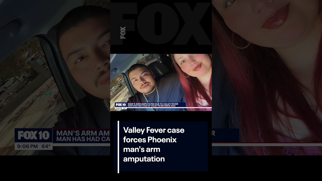 Valley Fever leads to amputation of Phoenix man's arm | FOX 10 Phoenix