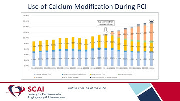 Best of JSCAI - Hot Topic Spotlight: Calcium Modification at SCAI 2025