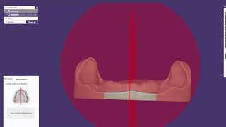 exocad Video Tutorial  Full Denture Design