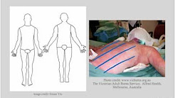 Burn Care - Burn Depth Classification 