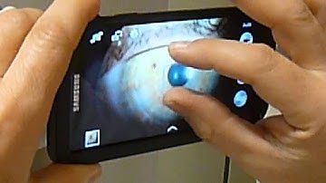 Proccedure to take pictures with mobile phone throught slit lamp