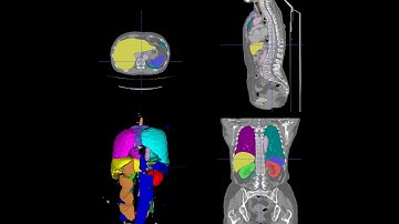 Train an Image Segmentation Model in 10 minutes Without Writing any Code