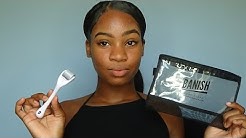 How I Faded My Acne SCARS | Banish Acne Scars