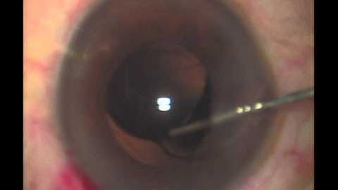 Dialling the trailing Haptic in the bag by Dr Irfan Khatib