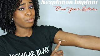 Nexplanon Implant | One Year Update !(Nexplanon implant one year update! Here is my experience in the first year! Two years to go! This birth control option was the best choice for me because of the ..., 2016-08-23T22:00:00.000Z)