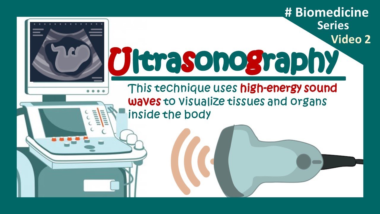 Ultrasonography Usg The Principles Of Ultrasound Imaging Clinical