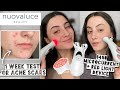 NUFACE DUPE? TESTING NUOVALUCE ANTI-AGING DEVICE | $450 MICROCURRENT + RED LIGHT FOR ACNE SCARRING