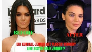 DID KENDALL JENNER GET PLASTIC SURGERY LIKE SISTER KYLIE JENNER ?