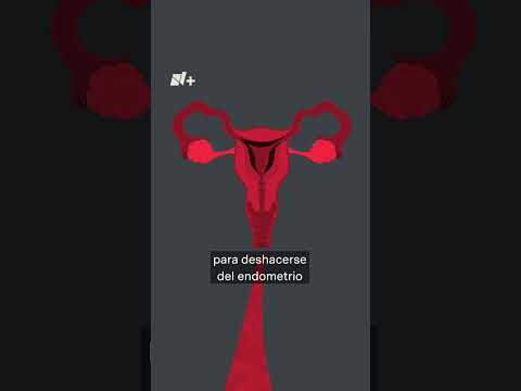 Video: 13 formas de deshacerse de los calambres menstruales