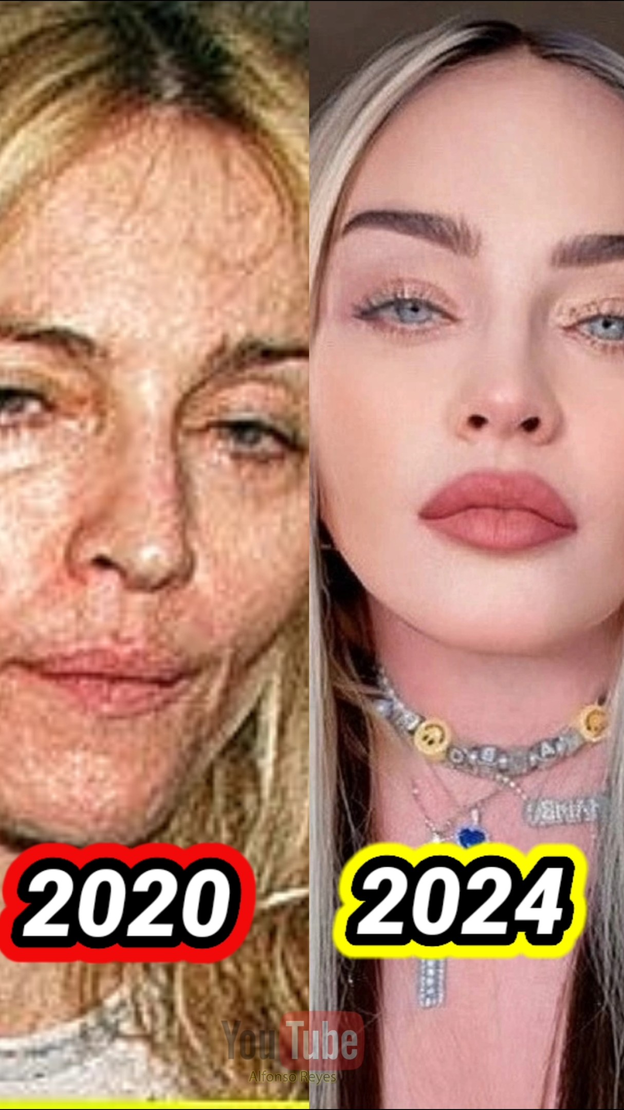 Esto se hizo Madonna para parecer más joven. #madonna #belleza