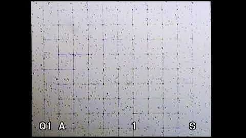 Sperm Count Testing as Viewed Through a Microscope