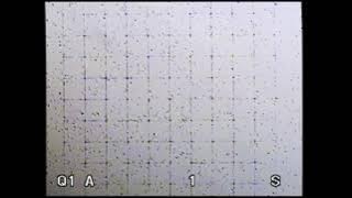 Sperm Count Testing as Viewed Through a Microscope