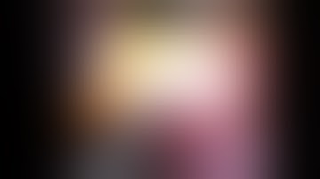 laparoscopic D2 subtotal gastrectomy for Locally AGC with Bulky lymph nodes- Jaideep Raj Rao