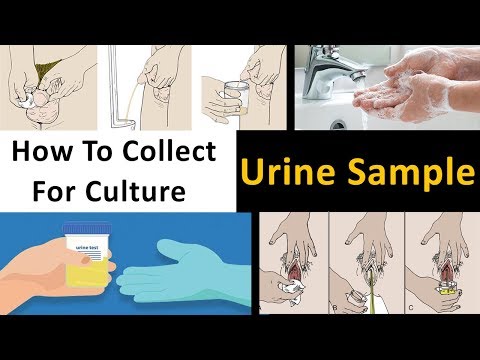 Video: How To Collect Daily Urine For Analysis