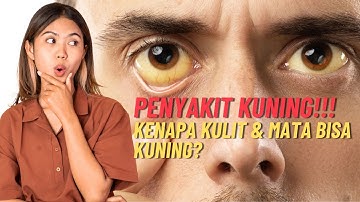 Penyakit Kuning: Kenapa Kulit dan Mata Bisa Menguning? Ini Penjelasannya!