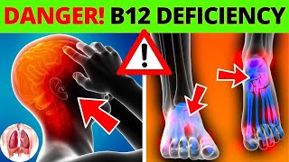 ⚠️ Top 10 DANGERS of Vitamin B12 Deficiency ▶ BEWARE ❗