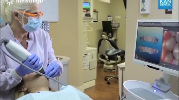 QUY TRÌNH NIỀNG RĂNG INVISALIGN TẠI KANDENTAL