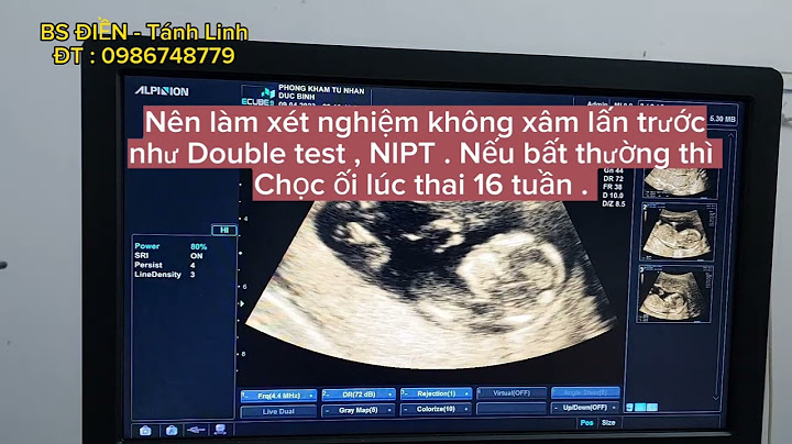 Siêu âm đo độ mờ da gáy như thế nào