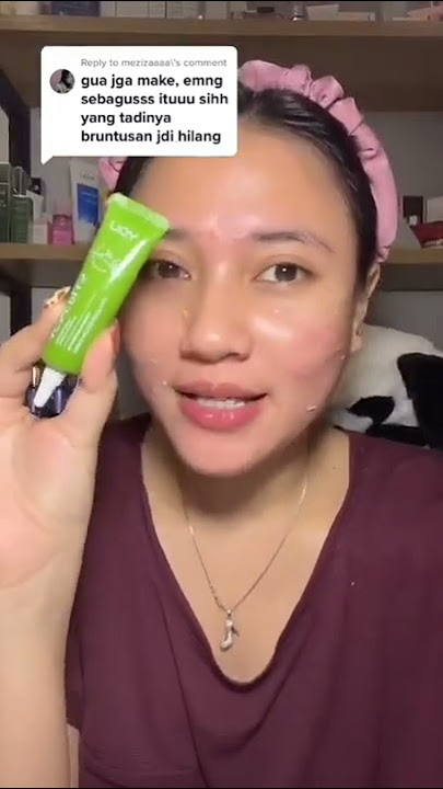 ACNE SPOT yang bikin jerawat atau brutusan hilang