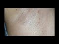 Shaving my armpit- Man vs Woman razor + Time-lapse of Hair Growth 🤗