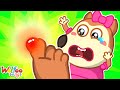 Baby got a boo boo  the biting monster song  kids songs  wolfoo nursery rhymes