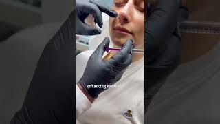 Erase Smile Lines Fast ✨ #EraseSmileLines #SmileLinesTreatment #NasolabialFolds