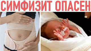 СИМФИЗИТ ВО ВРЕМЯ БЕРЕМЕННОСТИ | Почему при беременности появляется симфизит и как его лечат
