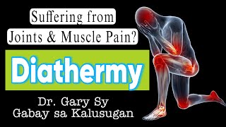 DIATHERMY: Types, Benefits & Risks - Dr. Gary Sy by Gabay sa Kalusugan - Dr. Gary Sy 18,746 views 3 months ago 23 minutes