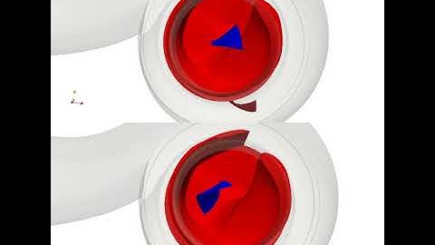 Parametric study for the transport of a rag in a centrifugal pump - bottom view