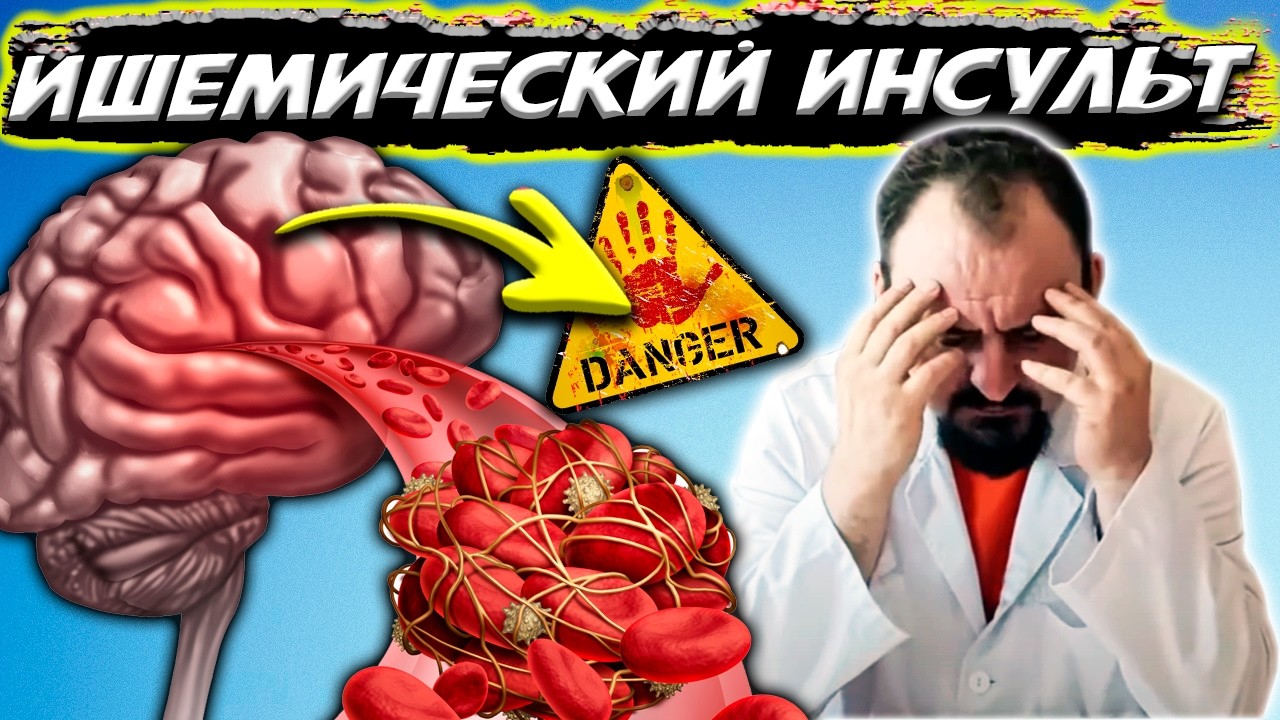 САМОЕ ГЛАВНОЕ Ишемический инсульт. Как СПАСТИ СОСУДЫ Головного Мозга?