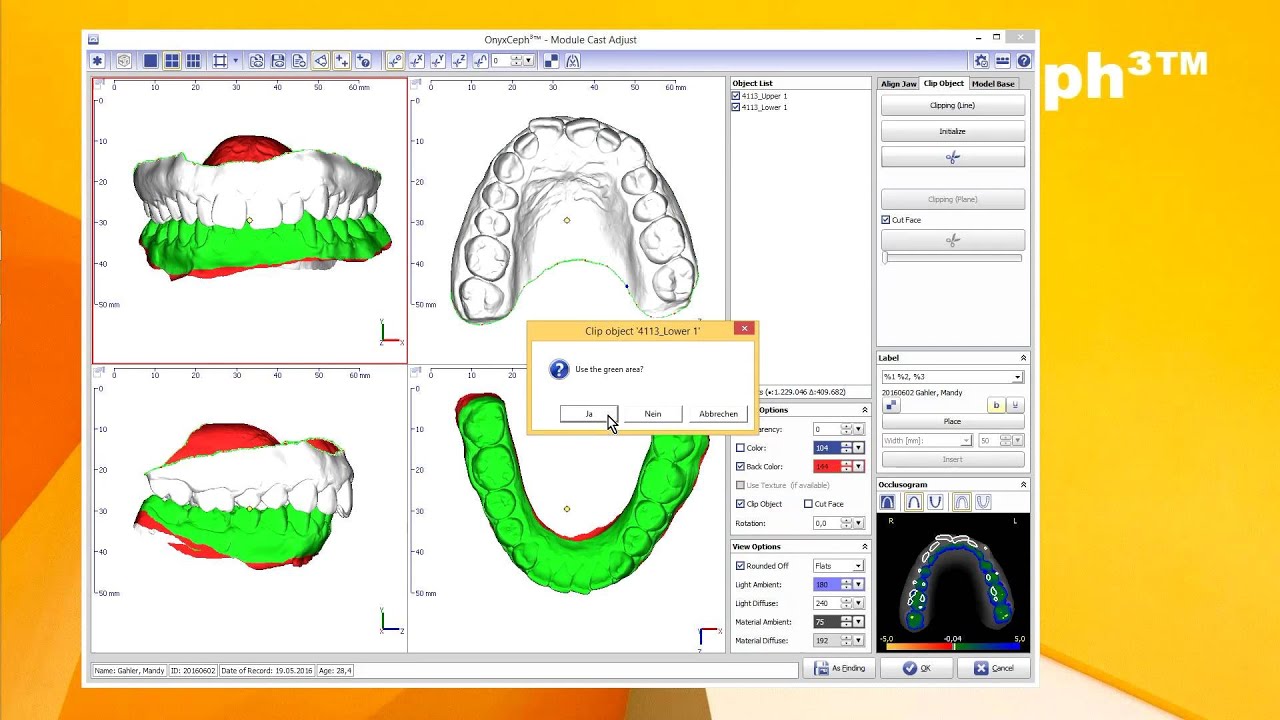 Oneceph Onyxceph Anwenderorientierter Vergleich Zweier Scansysteme Eines ...