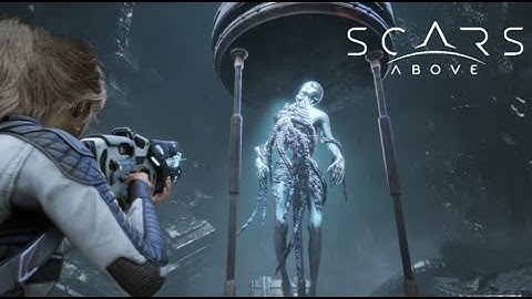 ♡ SCARS ABOVE - CHAPTER 4 (The code of life)