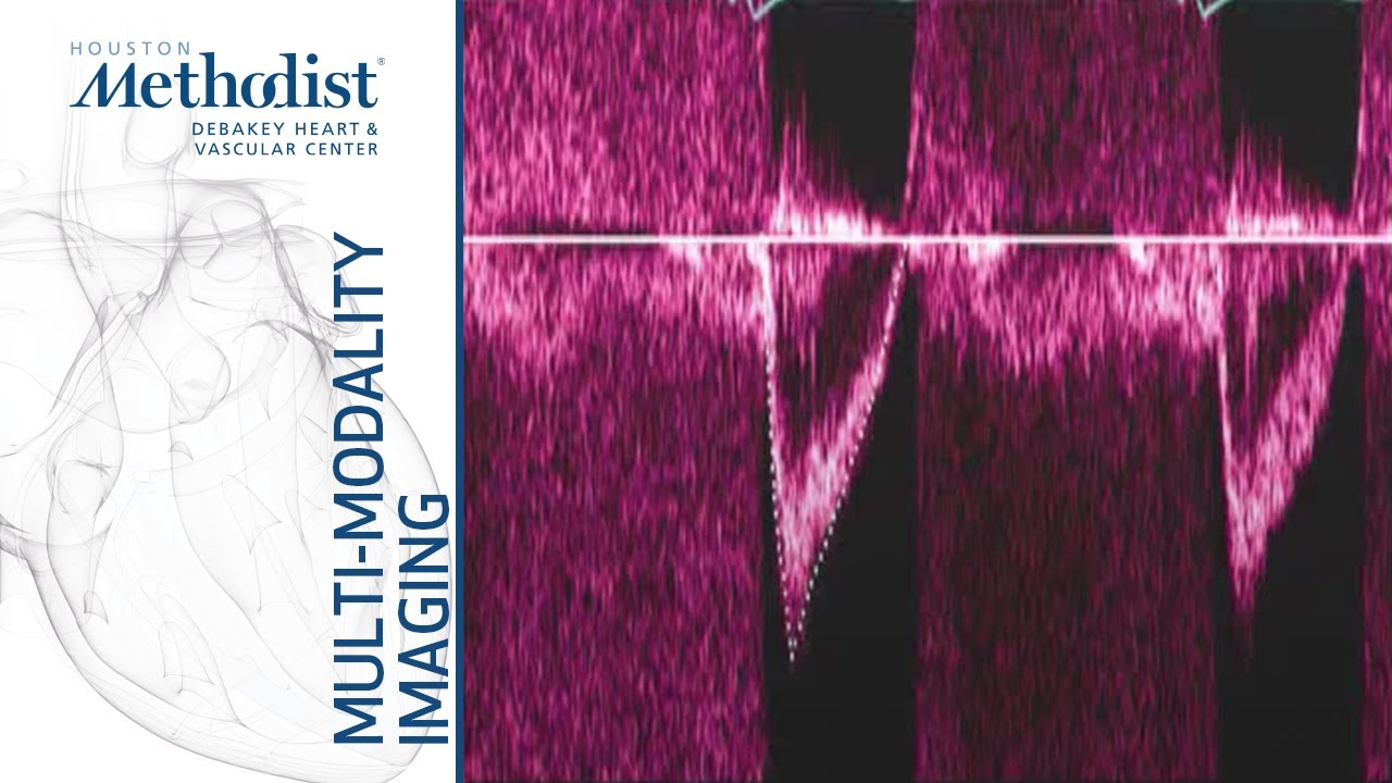 Echo Assessment of Hemodynamics (Sherif F. Nagueh, MD) October 20, 2020