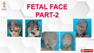 Fetal Face part 2