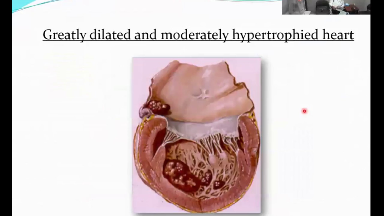 Sports Medicine ECHO Protecting the Heart of the American Athlete 10