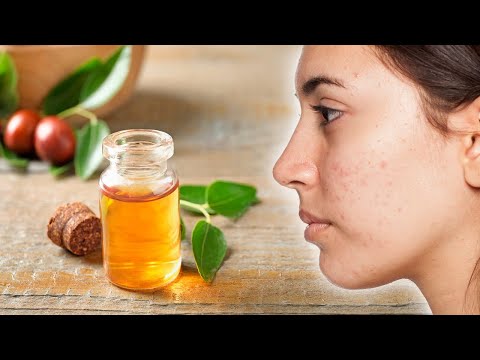 Video: Quando scade il jojoba?