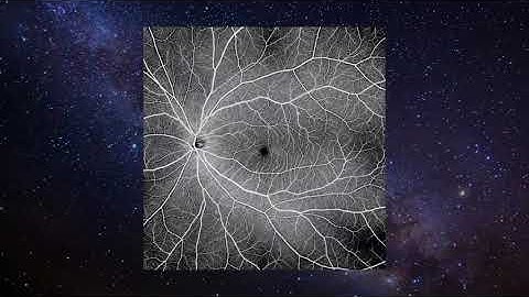 Canon Xephilio OCT-A1 Introduction Video