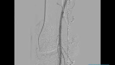 Big Boss SFA Cross 1