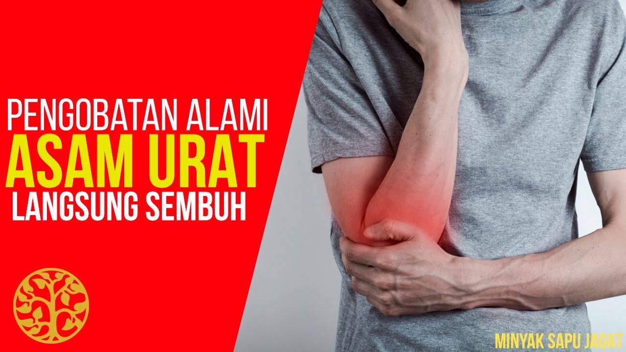 Mengobati Asam Urat dengan Minyak Sapu Jagat - Alami & Efektif !