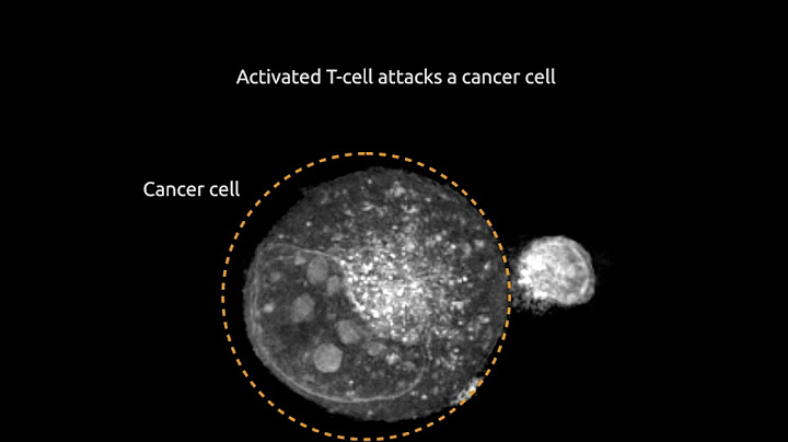 Activated T cell attacks a cancer cell