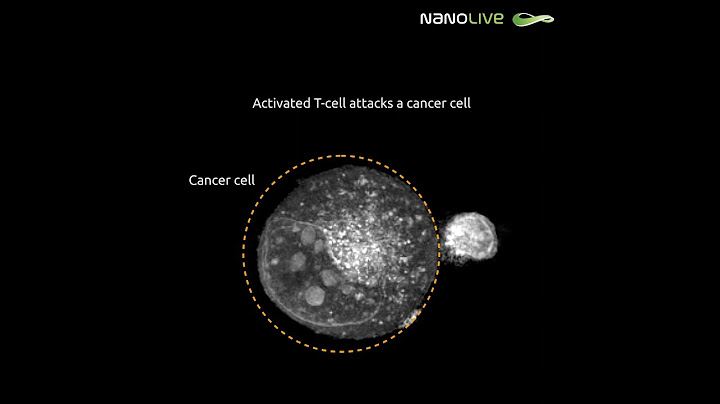 Activated T cell attacks a cancer cell