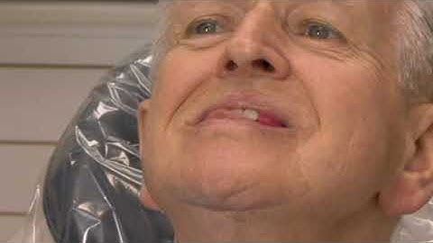 Denture Bootcamp Series Part IV-B: Diagnostic Records II