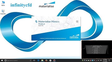 How to import CT-Scan images into Mimics for 3D geometry extraction.
