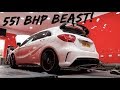 COLLECTING MY *551BHP* MERCEDES A45 AMG!!! *UK'S MOST POWERFUL*