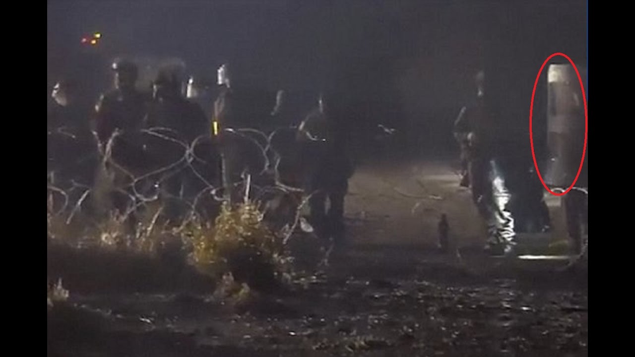 Dad of injured Dakota Access oil pipeline protester speaks out | Latest News