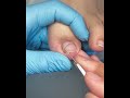 Gentle Toe Grooming | Fresh and Healthy Nail Look  #toenailcare #pedicure #pedicureroutine #fypシ